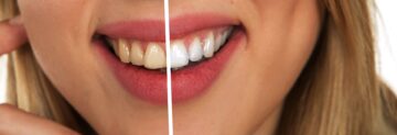 bright smile dental