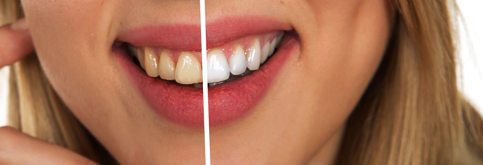 bright smile dental